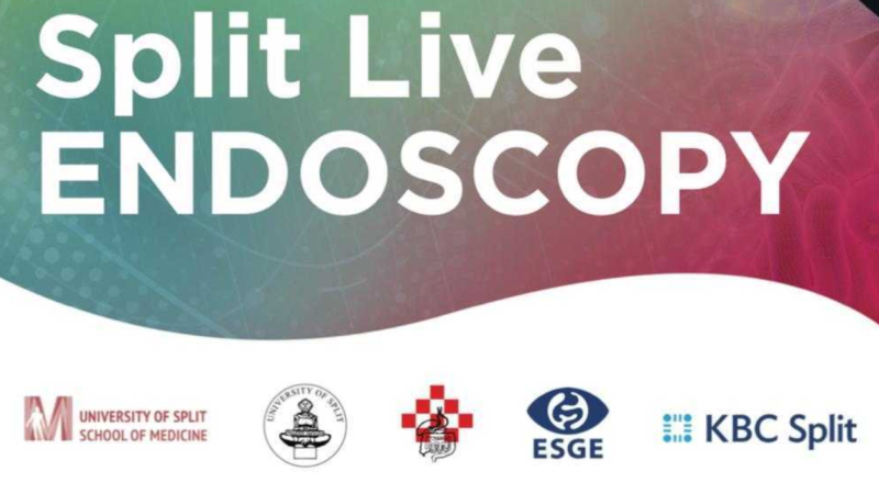 split live
